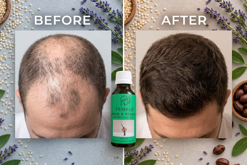 Temple Scalp & Hair Growth Oil